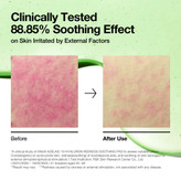 پد تونر آزلائیک اسید 10 درصد و هیالورون آنوا