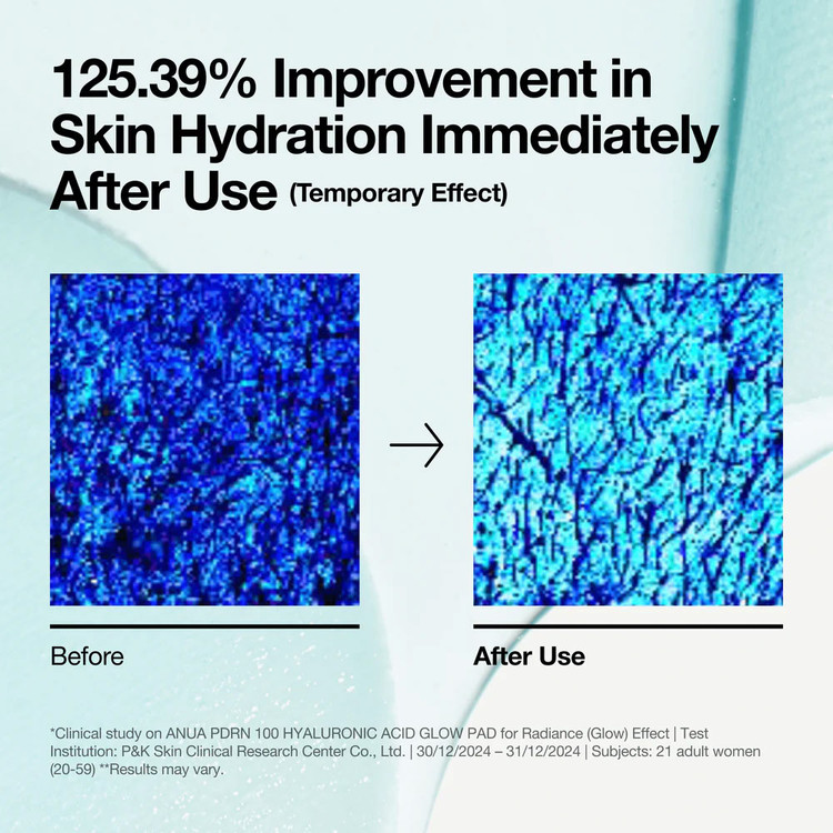 پد تونر PDRN و هیالورون آنوا