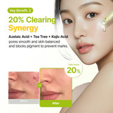سرم آزلائیک اسید 10% ضد لک و شفاف کننده پیوریتو
