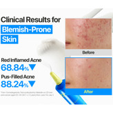 کرم ضدجوش و اصلاح کننده لک 3 برابری نامبوزین